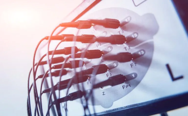 Could Electrotherapy Help Treat Anorexia Nervosa?