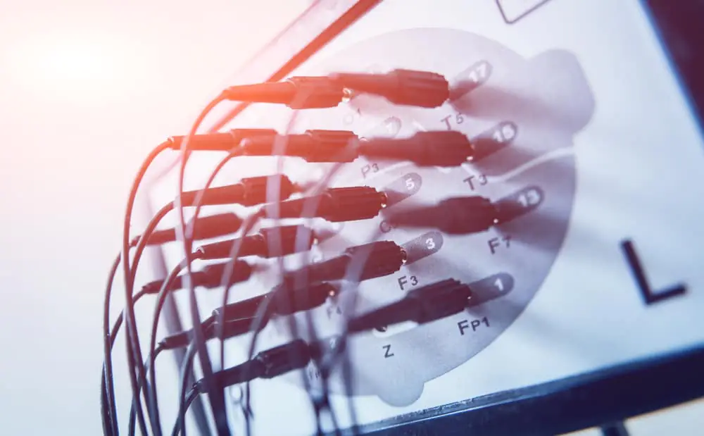 Could Electrotherapy Help Treat Anorexia Nervosa?