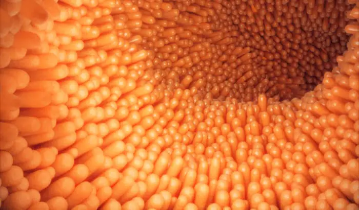 New intestinal cancer treatment approach intestine
