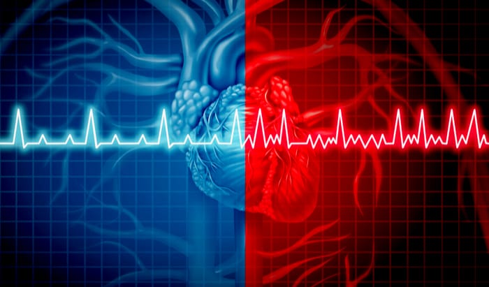 An obese heart is a silent risk obese heart