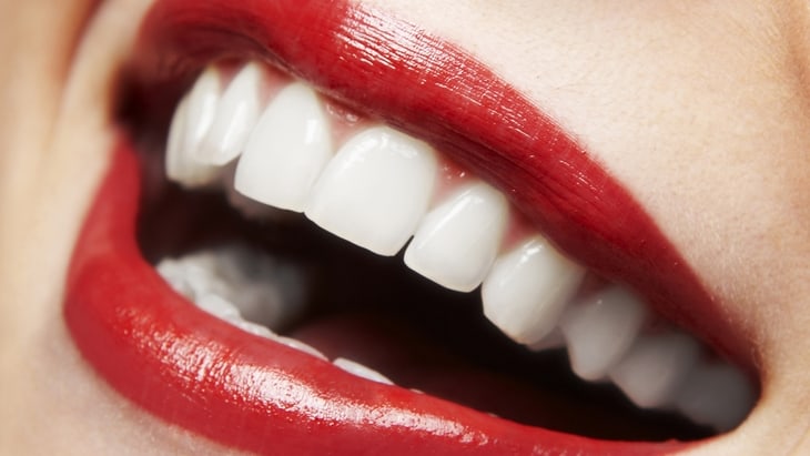 Gum Disease Doubles Stroke Risk oral health