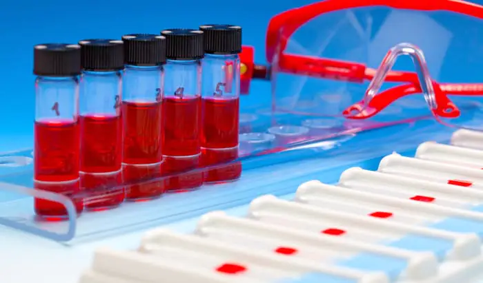 Liquid biopsy gives new insight into breast cancer prognosis liquid