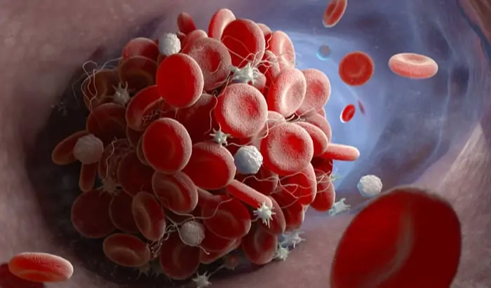 High thrombotic risk in cancer patients receiving immunotherapy