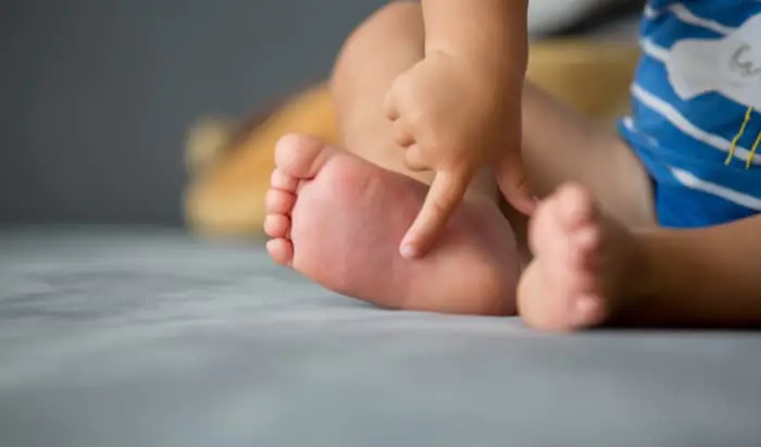Summer sickness – 6 common illnesses