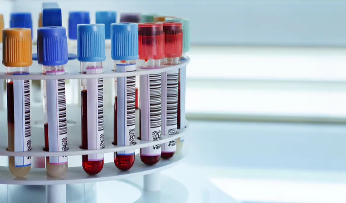 New blood biomarker: fatty liver disease