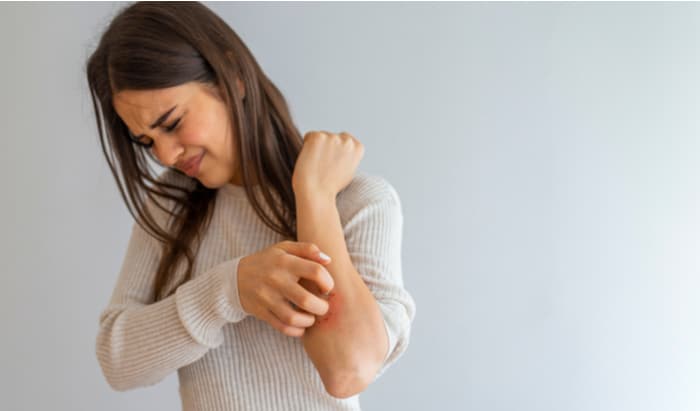 New molecular mechanisms identified in dermatitis