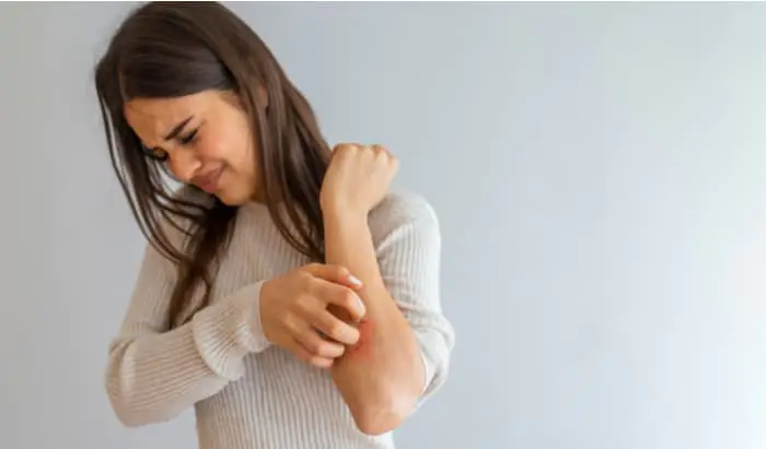 New molecular mechanisms identified in dermatitis molecular mechanisms
