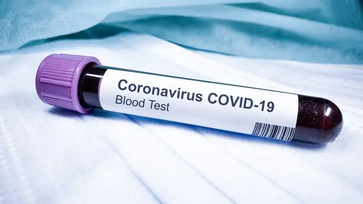 Home testing to track infection levels in community