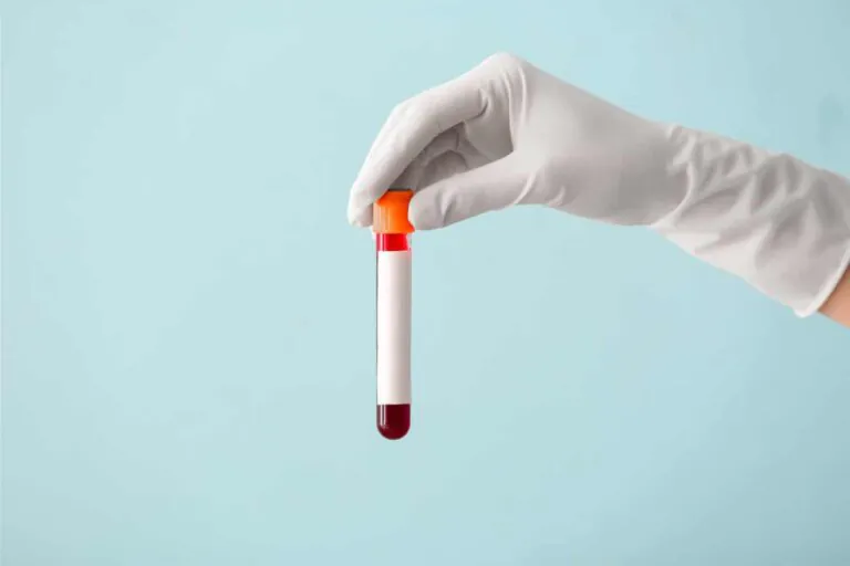 Trial for blood tests to diagnose dementia accepts first participants