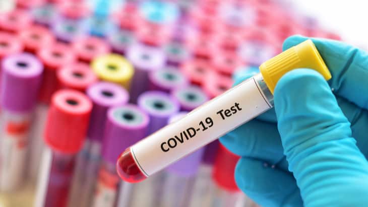 Covid-19: TAPb accelerates clinical trials by providing patient samples