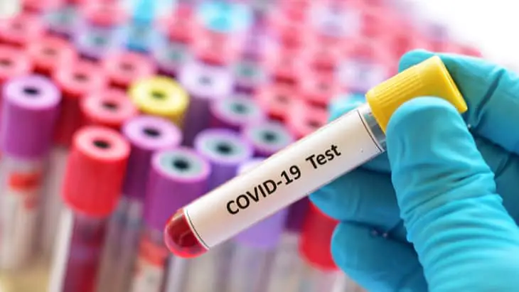 Covid-19: TAPb accelerates clinical trials by providing patient samples