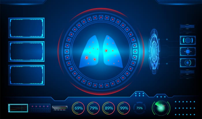 Covid-19: AI auto-scans lung X-rays