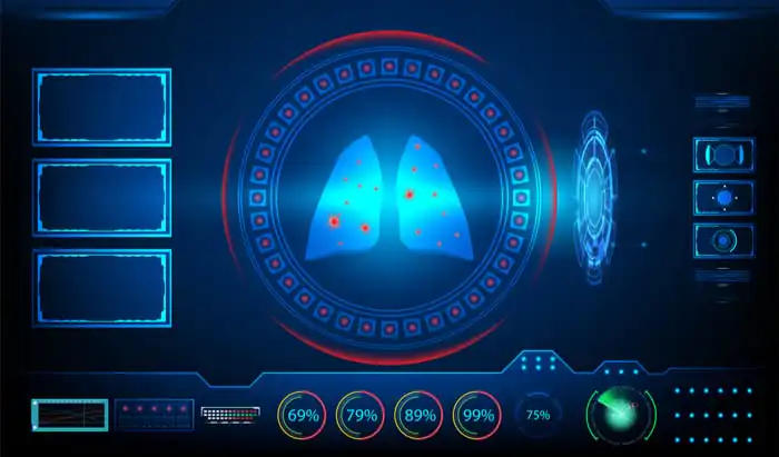 Covid-19: AI auto-scans lung X-rays
