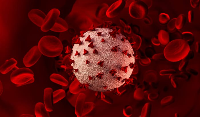 Anticoagulant has benefits for COVID-19 patients