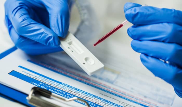 Covid-19: Expert comment on antibody tests