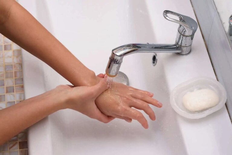 Burns – the best advice for treating a burn