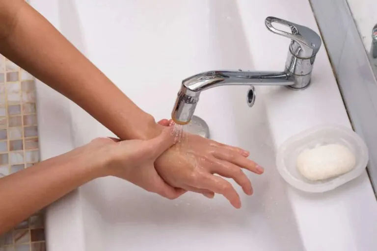 Burns – the best advice for treating a burn