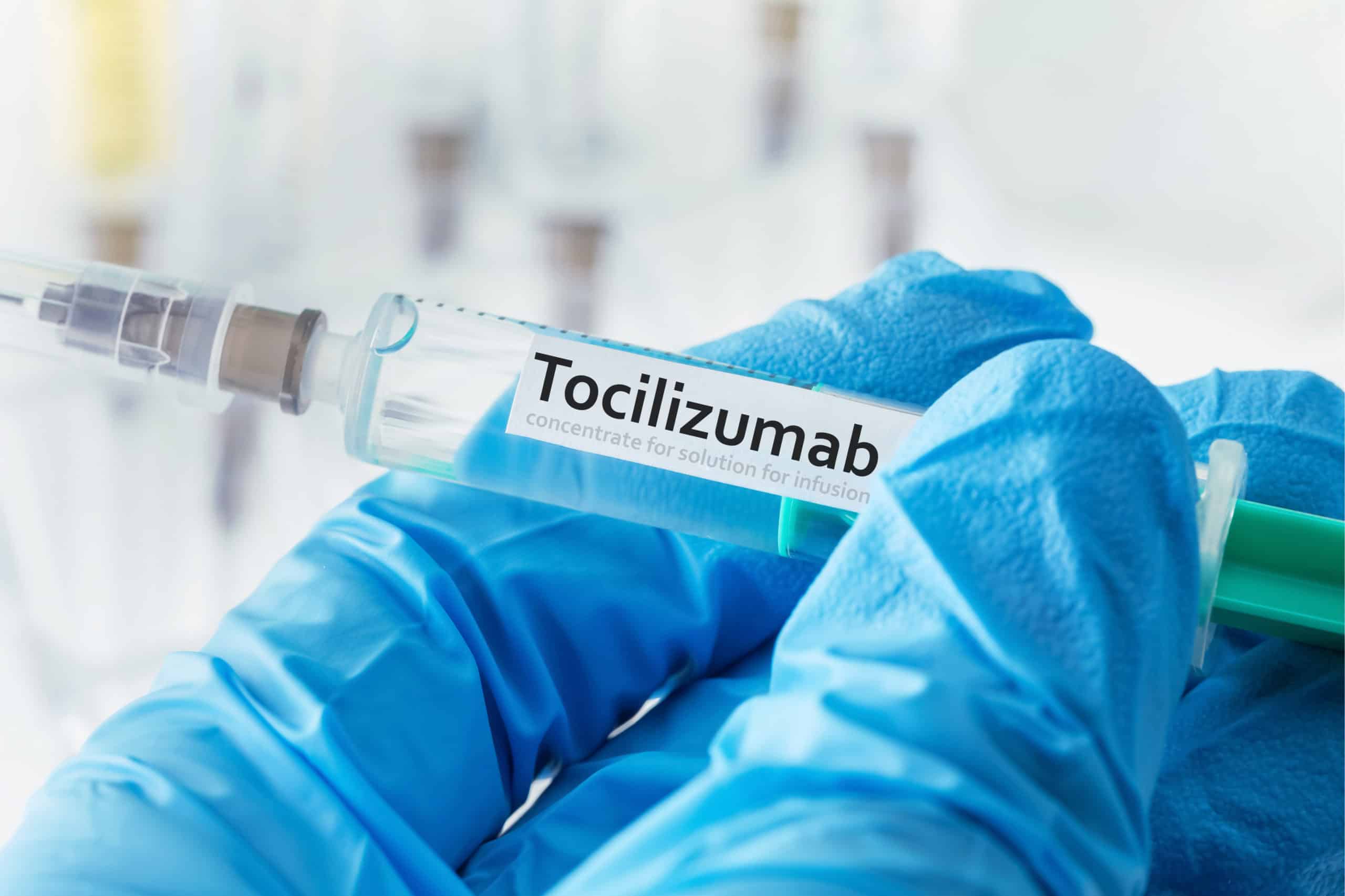 Arthritis drug effective in treating sickest COVID-19 patients drug