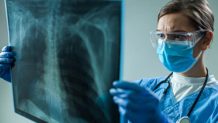 Referrals of urgent care lung conditions drop by up to 70%