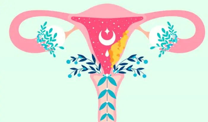 Support with weight after endometrial cancer endometrial cancer