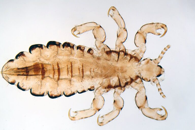 Headlice affects parents too