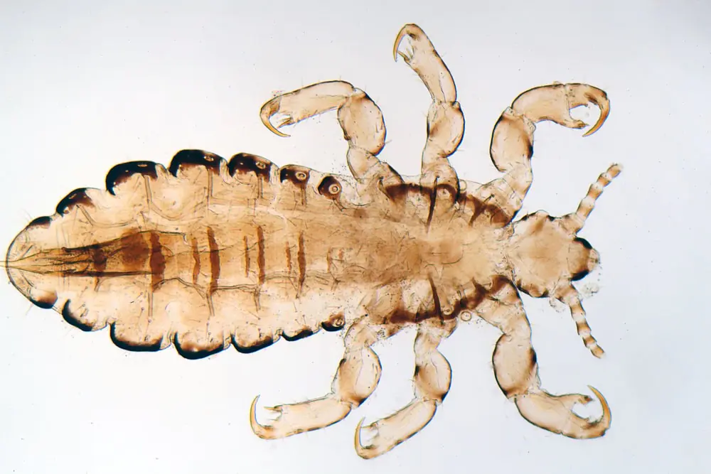 Headlice affects parents too