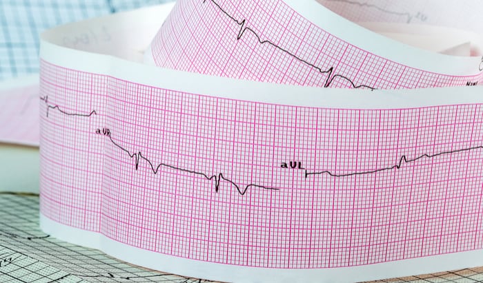 Take your places for the Heart Rhythm Congress