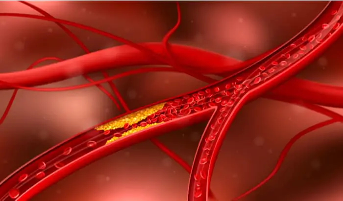 Cytokine APRIL protects from atherosclerotic cardiovascular disease