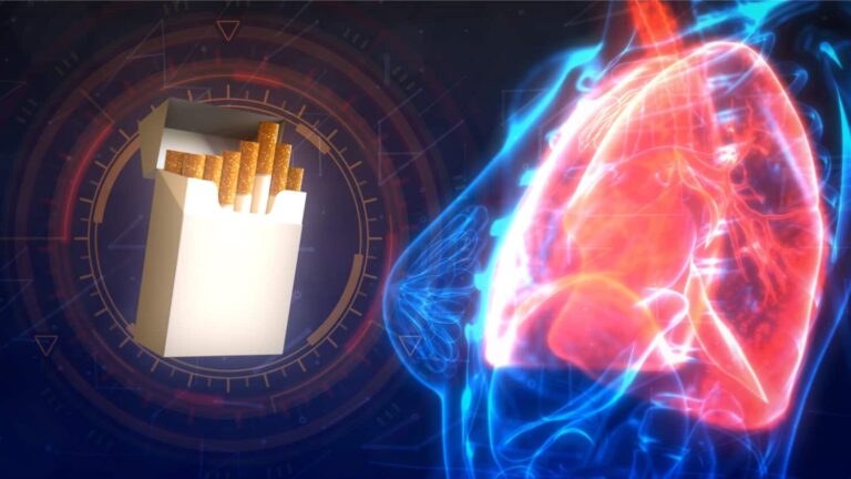 Smokers at increased risk of recurring pneumonia