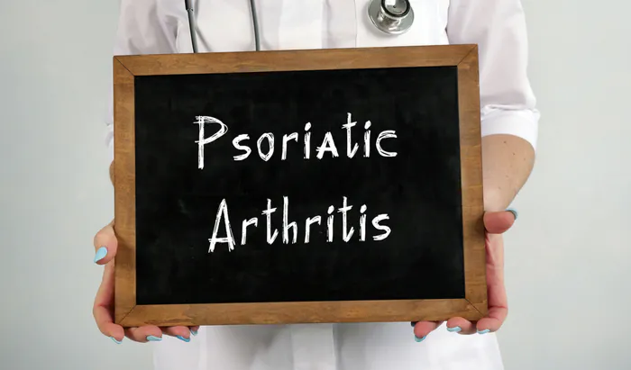 Psoriasis and psoriatic arthritis treatment shift Psoriasis