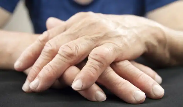 Advice for caregivers of people with dementia during COVID-19