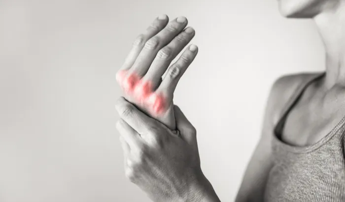 Expert webinar on community rheumatology