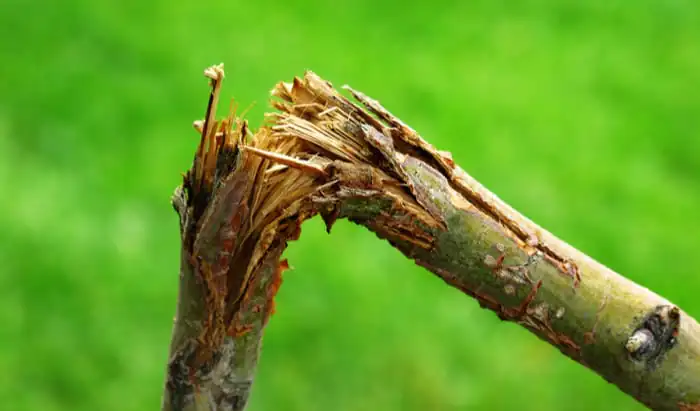 Breaks, sprains and dislocations Breaks, sprains and dislocations