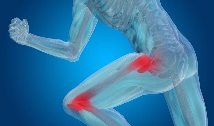 Avoiding surgery by healing ACL rupture