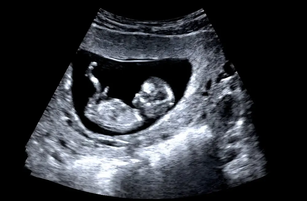 Manchester University to research the impact of CO on babies