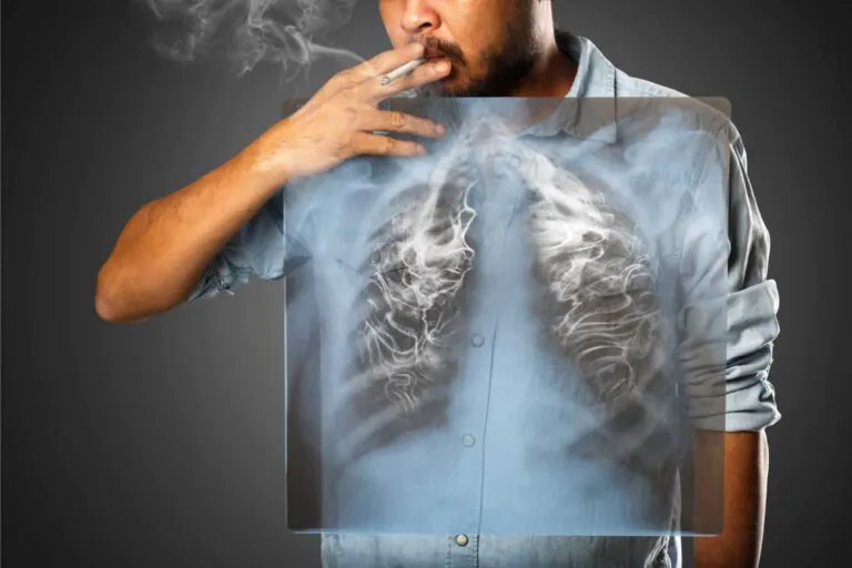 Different subtypes defined in small cell lung cancer