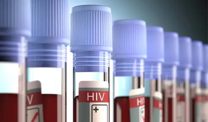 National HIV Testing Week is Here!