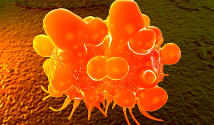 Increasing sensitivity of bowel cancer test