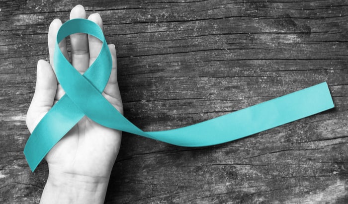 Urgent ovarian cancer symptoms ignored during lockdown symptoms