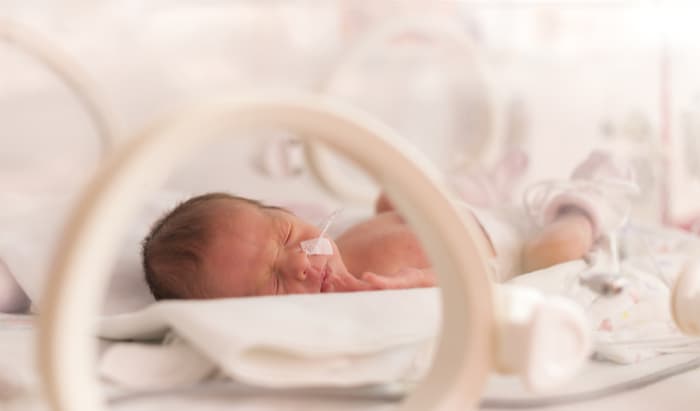 premature infants