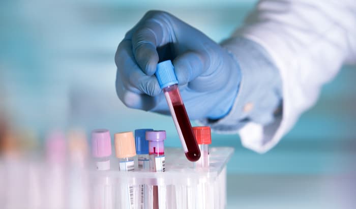 Patients value NHS diagnostic services but face barriers to access