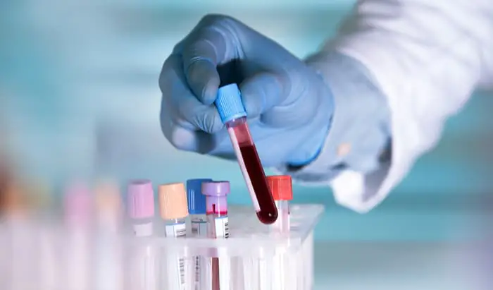 blood test