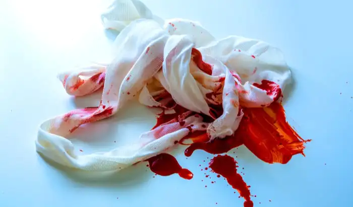 First aid for stabbings