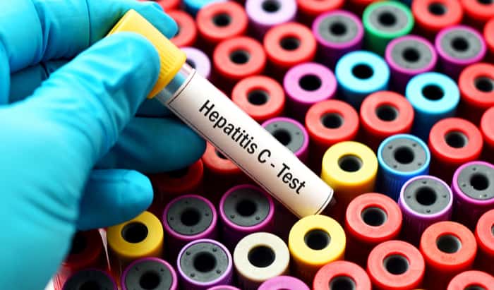 World Hepatitis Day: the missing millions