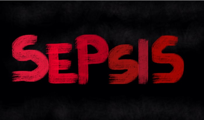 The six signs of sepsis