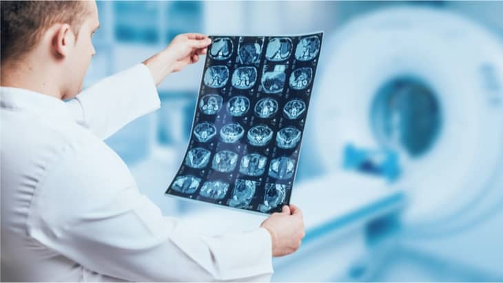 Infant brain tumours could benefit from targeted treatment