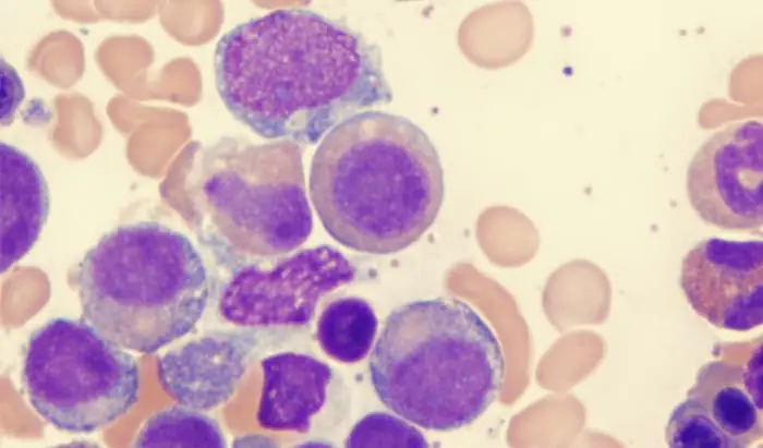 Queen’s University Belfast Awarded Research Grant to Improve Bone Marrow Cancer Treatment