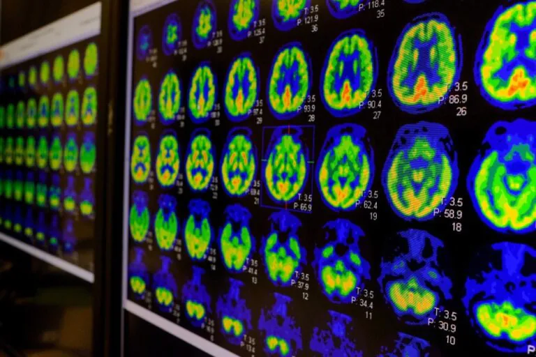 Worrying Rise in Meningitis Cases