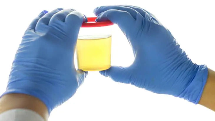 How to lessen contamination rates in urine samples urine